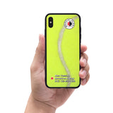 Custom Medical Alert iPhone Case (Tennis Pattern) - hipave